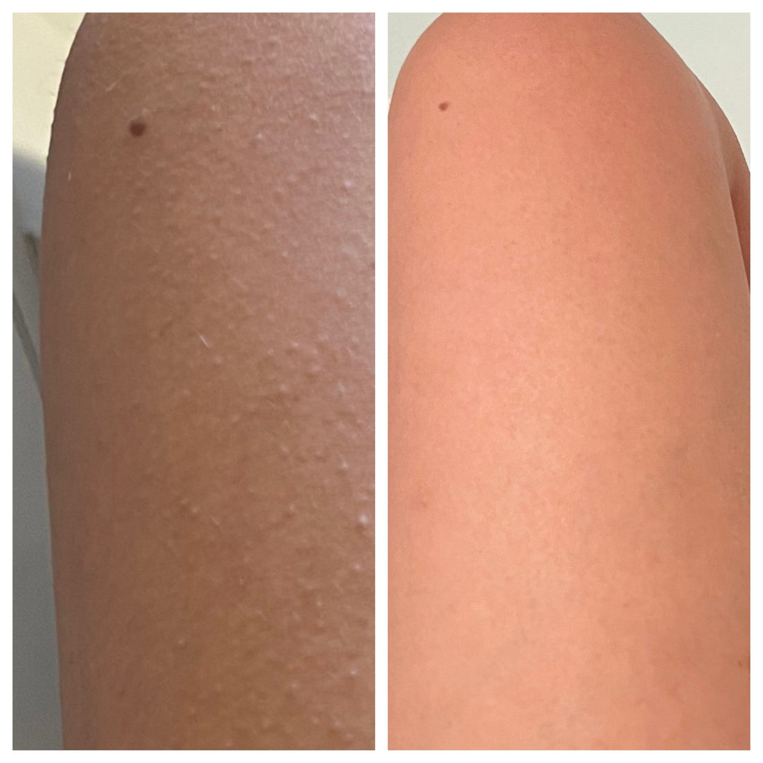 Reveal Smooth and Radiant Skin: The Benefits of Exfoliating 1-2 Times a Week