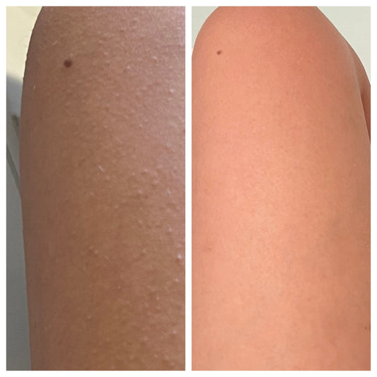 Reveal Smooth and Radiant Skin: The Benefits of Exfoliating 1-2 Times a Week